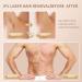Women's At-Home IPL Hair Removal Device - Painless & Permanent Laser Hair Remover with Ice Cooling Function - 999,900 Flashes - Rose Gold - Buy Online on GoSupps.com