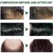 Hair Growth Shampoo Anti-Hair Loss & Hair Strengthening Shampoo Champoing for Hair Regrowth Hair Strengthening Shampoo for Hair Growth Hair Loss Shampoo for Men & Women - Buy Online on GoSupps.com
