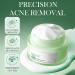 Salicylic Acid Acne Cream 50g - 3% BHA Spot Cream for Acne - Blackhead Remover - Dark Spot Remover for Face - Scar Removal Cream - Moisturizing Face Cream for Women - Pimple Cream for Redness - Buy Online on GoSupps.com