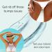 Razor Bump Treatment for Bikini Area - Ingrown Hair Serum for Men & Women | Dark Spot Corrector | Made in USA | Say Goodbye to Razor Burns - Buy Online on GoSupps.com