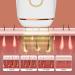 IPL Hair Removal Device - Portable & Compact for Face Legs Armpits & Bikini Area - Best eCommerce Solution - Buy Online on GoSupps.com