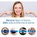 Hermon Premium Teeth Whitening Pen - Pain-Free, Sensitivity-Free, Removes Stains for Whiter Teeth - Buy Online on GoSupps.com