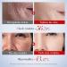 Snail Oil Snail Face Serum Snail Mucin Essence Snail Mucin Face Cream for Anti Wrinkle Hydrating Hyaluronic Acid Serum Niacinamide Serum Moisturzing Body Face Oils and Serums - Buy Online on GoSupps.com