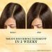 Indu..lekha Sve..tak..utaja Scalp Serum Dandruff Treatment Silicone & Paraben Free Ayurvedic Formula - Buy Online on GoSupps.com