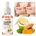 Turmeric Dark Spot Corrector Serum - Acne, Hyperpigmentation, Smooth Skin - Hyaluronic Acid, Vitamin C & E - 1.01 FL.OZ - Buy Online on GoSupps.com