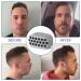 BSitsss 6-Piece Jawline Trainer Set | Kiefer Trainer & Jaw Coach for a Defined Jawline | Silicone Exerciser & Double Chin Reducer - Buy Online on GoSupps.com