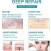 Silicone Scar Sheets 1.6 x 60 - Surgical C-Section Keloid Acne Burn Scars Tape - Buy Online on GoSupps.com