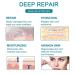 Medical Grade Silicone Scar Tape Roll (1.6 x 60) for Scar Removal - Professional Silicone Strips for Surgery, C-Section, Acne, Burn and Keloid - Safe & Reusable - 1.5M - Buy Online on GoSupps.com