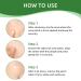 Hydrocolloid Acne Blemish Patch Fast Healing for Clear Skin | International Shipping Available - Buy Online on GoSupps.com