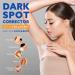 Buy Dark Spot Cream - Effective Dark Spot Remover for Face & Body | 50ml Dark Spot Corrector for Neck Hands Legs & Intimate Areas - Buy Online on GoSupps.com