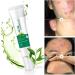 Anti Acne Face Cream Acne Treatment Cream Acne Cream Acne Spot Treatment Acne Scar Treatment Tea Tree Cream Acnecide Gel Skin Treatment Gel Cream For Face Blemishes & Blackheads 20G - Buy Online on GoSupps.com