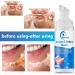 2 Pack Aligner Cleaner & Whitener Paste Foam for Dentures, Mouth Guards - Fast-Acting Retainer Alternative - Teeth Whitening & Bad Breath Fighting Formula - Buy Online on GoSupps.com