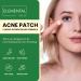 Elemental Acne Patches - Fast-Acting Hydrocolloid Spot Treatment for Clear Skin | 36 Pimple Stickers for Zits & Blemishes - Buy Online on GoSupps.com