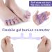 Molain 8 Pack Gel Nail Polish Toe Spacers - Silicone Separators for Overlapping Toes Hammer Toe Relief - Transparent Pink Blue & Purple - Buy Online on GoSupps.com
