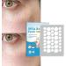 irene inevent Moisturizing Milia Remover Patch Sticker for Clear and Skin - Buy Online on GoSupps.com