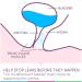 Poise Impressa Incontinence Bladder Supports Sizing Kit - 3 Count - Buy Online on GoSupps.com