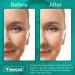 Retinol & Collagen Anti-Aging Cream - Day & Night Face Moisturizer - Buy Online on GoSupps.com
