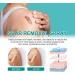 DUBUSH Scarremove Advanced Scar Spray - For Acne, Surgical Scars & Stretch Marks - Gentle Skin Care - 2pcs - Buy Online on GoSupps.com