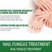 Antifungal Nail Treatment for Toe Fungus - 2-in-1 Solution to Treat and Prevent Nail Fungal Infections - Buy Online on GoSupps.com