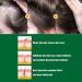Ginger Anti Hair Loss Serum for Hair Regrowth - Men & Women - 3pcs 1 Fl Oz - Buy Online on GoSupps.com