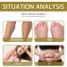Lukmlca Bee Venom Lymphatic Drainage & Slim_ming Foot Soak Beads Lukmlca Bee Venom Foot Soak Cleansing Foot Soak Beads Lukmlca Bee Venom Lymphatic Drainage Foot Soak (7pcs/ 1 pack) - Buy Online on GoSupps.com