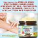 Botanical Beauty KOKUM BUTTER 100% Pure Natural REFINED Cold-Pressed for Face Skin Body Hair Lip Nails. Rich in Vitamin E. Beauty Moisturizing Nourishing Butter Rich in Vitamin E (4 Fl Oz) 4 Fl Oz (Pack of 1) - Buy Online on GoSupps.com