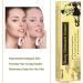 Moisturising Cream Body and Face Moisturizer for Dry Skin Acne Cream 2PC 0.53 Ounce (Pack of 2) - Buy Online on GoSupps.com