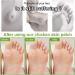 72 Pieces Corn Paving for Stubborn Chicken Eyes Removal - Effective Foot Sole Treatment - Buy Online on GoSupps.com