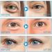 Eye Cream - Under Eye Cream Coffee Extract Eye Cream | Instant Eye Bag Removal Cream With Natural Ingredients Natural Firming Skin Eye Moisturizer For Women Girls - Buy Online on GoSupps.com