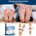 Mymulike 24 Count Chicken Pots - Effective Foot Care for Chicken Eyes & Corn Removal - Buy Online on GoSupps.com