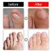 Ingrown Toenail Serum | Nail Care Oil for Brittle & Discolored Nails - 10ml - Hard Nail & Skin Treatment - Buy Online on GoSupps.com