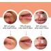 PEEWF Cold Sore Treatment Device - Red & Blue Light Therapy for Fast Relief - Buy Online on GoSupps.com