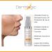 Max Strength Acne Face & Body Cream - Treat Cystic Blackhead & Whitehead Pimples Prevent Future Breakouts - Buy Online on GoSupps.com