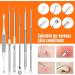 Blackhead Tweezers Kit Blackhead Remover Tools Kit Acne Extractor Tool Professional Stainless Pimple Acne Blemish Removal Tools with Portable Case (13-PCS) - Buy Online on GoSupps.com
