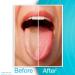 Dr. Tung's Stainless Steel Tongue Cleaner - Assorted Colors | Effective Oral Hygiene Tool - Buy Online on GoSupps.com