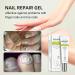 Yueci Hand & Foot Care Cream - Heal Cracked Nails & Toenails | Nail Repair Treatment (2PCs) - Buy Online on GoSupps.com