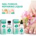 dhcprj Kerassentials Toenail Fungus Treatment Oil Toenail & Nail Care Solution Safe & Effective Repairs & Renewals Easy to Use Yellow Liquid - Buy Online on GoSupps.com