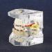 Dental Teeth Model with Metal Brackets - Orthodontic PVC Resin for Dental Schools - Buy Online on GoSupps.com