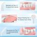 Portable Cordless Water Flosser with 4 Modes & 5 Jet Tips - Rechargeable & Waterproof Dental Oral Irrigator for Teeth Cleaning | Includes Travel Case - Buy Online on GoSupps.com