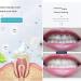 Fluoride-Free Whitening Toothpaste Foam - 3PCS Mousse Cleansing & Stain Removal with Baking Soda | 60ml - Buy Online on GoSupps.com