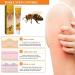 Bee Venom Psoriasis Treatment Cream - Soothing and Moisturizing Skin Relief - 3PCS - Buy Online on GoSupps.com