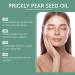 Prickly Pear Seed Oil Huile de p pins de figue de Barbarie bio press e froid anti- ge contre les rides et les cernes huile de graines de figue naturelle pour le visage et le corps (2) - Buy Online on GoSupps.com