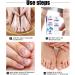 Fungal Nail Treatment Fungus Nail Cream Extra Strong Nail Fungus Treatment for Toenail Fix Renew Damaged Broken Anti Fungus Nail Repair - Buy Online on GoSupps.com