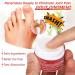 6Pcs Bunion Pain Relief Cream - Effective Relief for Bunion, Toe Stiffness, Gout, Cervical Spine, Joint, Knee - Buy Online on GoSupps.com