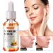 Turmeric Dark Spot Corrector Serum - Acne, Hyperpigmentation, Smooth Skin - Hyaluronic Acid, Vitamin C & E - 1.01 FL.OZ - Buy Online on GoSupps.com