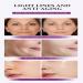 Retinol Cream 2.5% - Anti-Aging Moisturizer with Vitamin B5 | Hydrating & Smoothing Fine Lines | 10.15 Fl Oz - Best for Face & Body - Buy Online on GoSupps.com