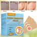Corn Removal Pads - 24pcs Corn Remover Treatment for Painful Corns and Calluses - Buy Online on GoSupps.com