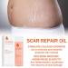Pregnancy Oil for Stretch Marks - 125ml Massage & Body Oil to Improve Skin Texture & Even Tone - Buy Online on GoSupps.com