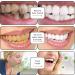 Probiotic Whitening Toothpaste Sp-7 Ultra Probiotic Whitening Toothpaste Sp-6 Anti-Stain Toothpaste Whitening Teeth Sp-6 3-Piece Set Probiotic Whitening Agent - Buy Online on GoSupps.com