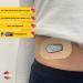 Peelz Dexcom G6 Adhesive Patches 25 Pack - Waterproof CGM Sensor Patches - US-Made for Sensitive Skin - Dexcom Stickers - Beige - Buy Online on GoSupps.com